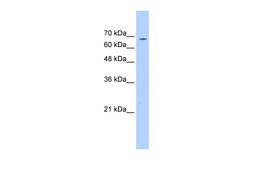 Antibody used in WB on Human Jurkat 0.2-1 ug/ml.