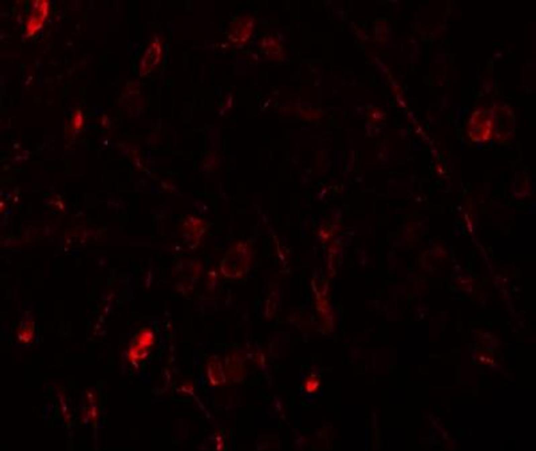 Immunocytochemistry/Immunofluorescence: WIZ Antibody [NBP1-76515] - Immunofluorescence of WIZ in human brain tissue with WIZ antibody at 20 ug/mL.