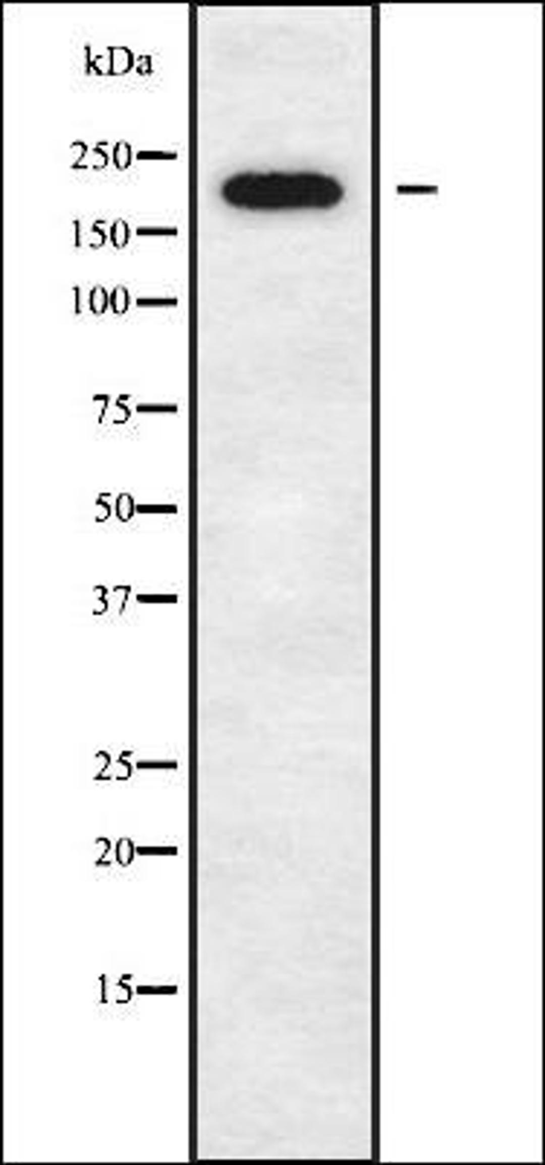 Western blot analysis of K562 whole cell lysates using DOCK11 antibody