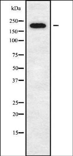 Western blot analysis of K562 whole cell lysates using DOCK11 antibody