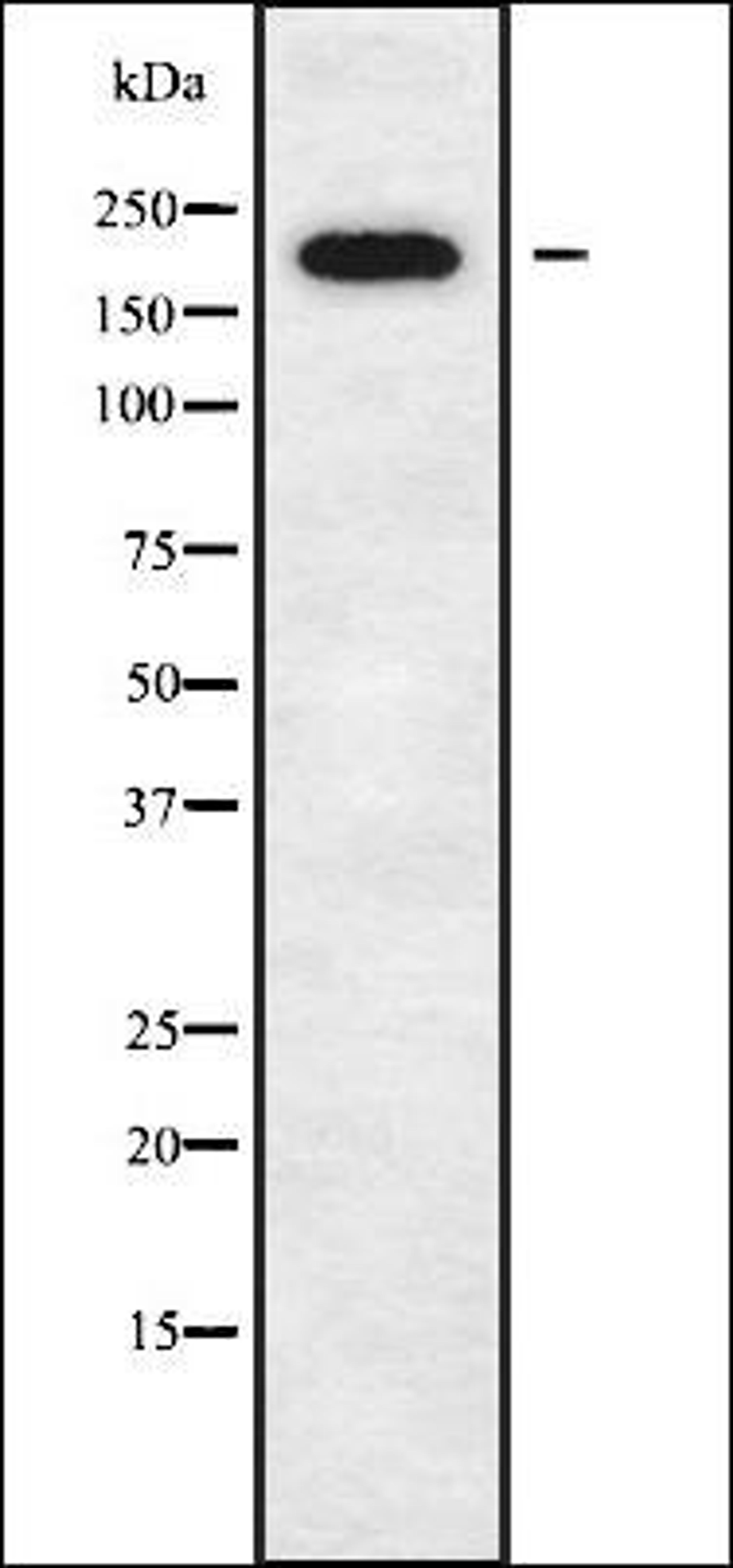 Western blot analysis of K562 whole cell lysates using DOCK11 antibody