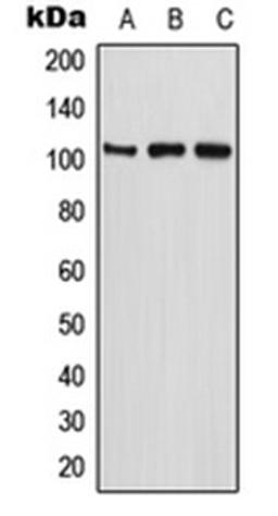 Western blot analysis of U2OS (Lane 1), MCF7 (Lane 2), PC12 (Lane 3) whole cell lysates using ETAA1 antibody