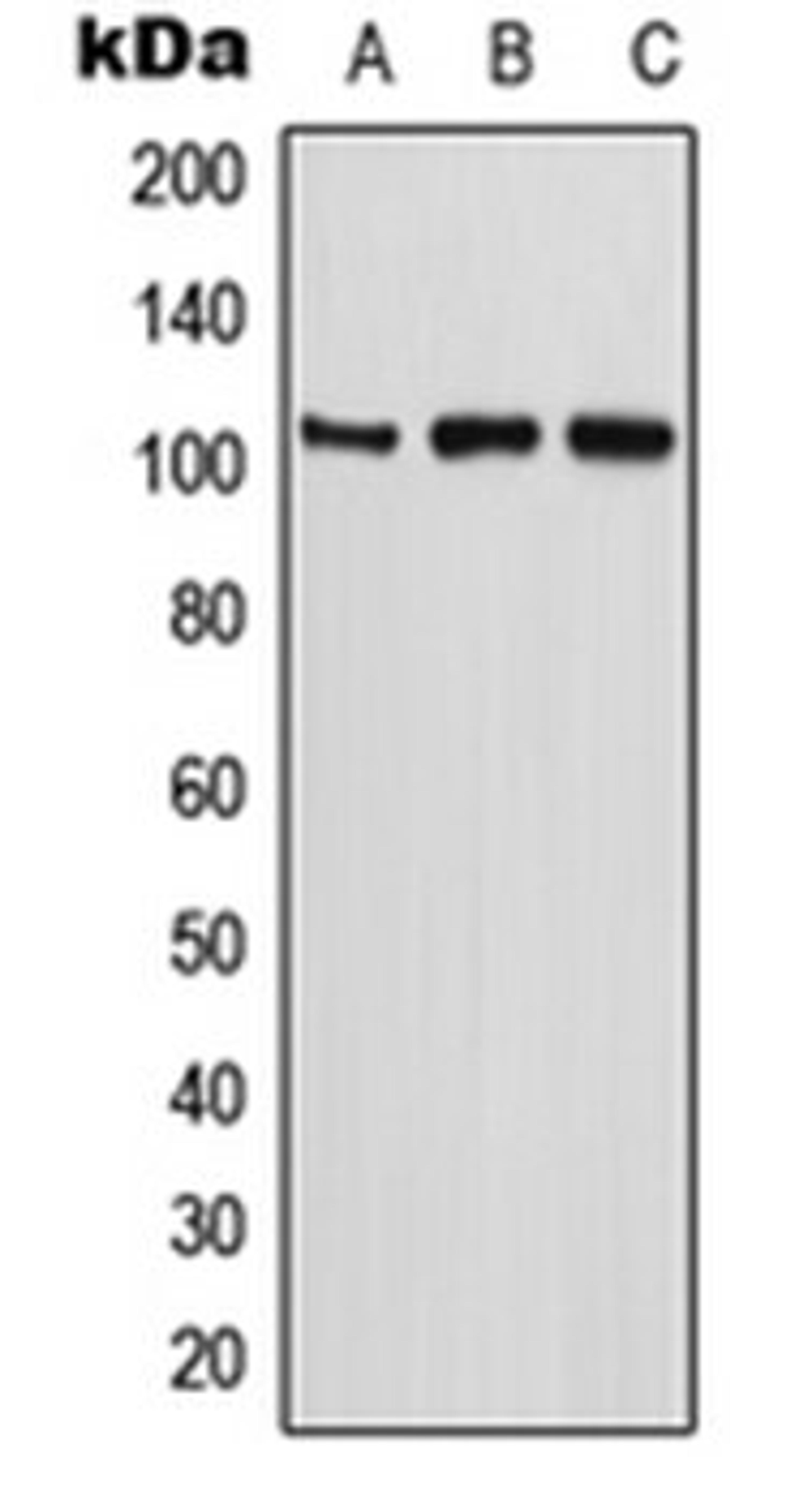 Western blot analysis of U2OS (Lane 1), MCF7 (Lane 2), PC12 (Lane 3) whole cell lysates using ETAA1 antibody