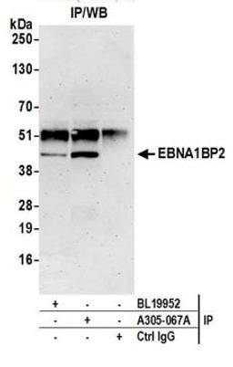 Detection of human EBNA1BP2 by western blot of immunoprecipitates.