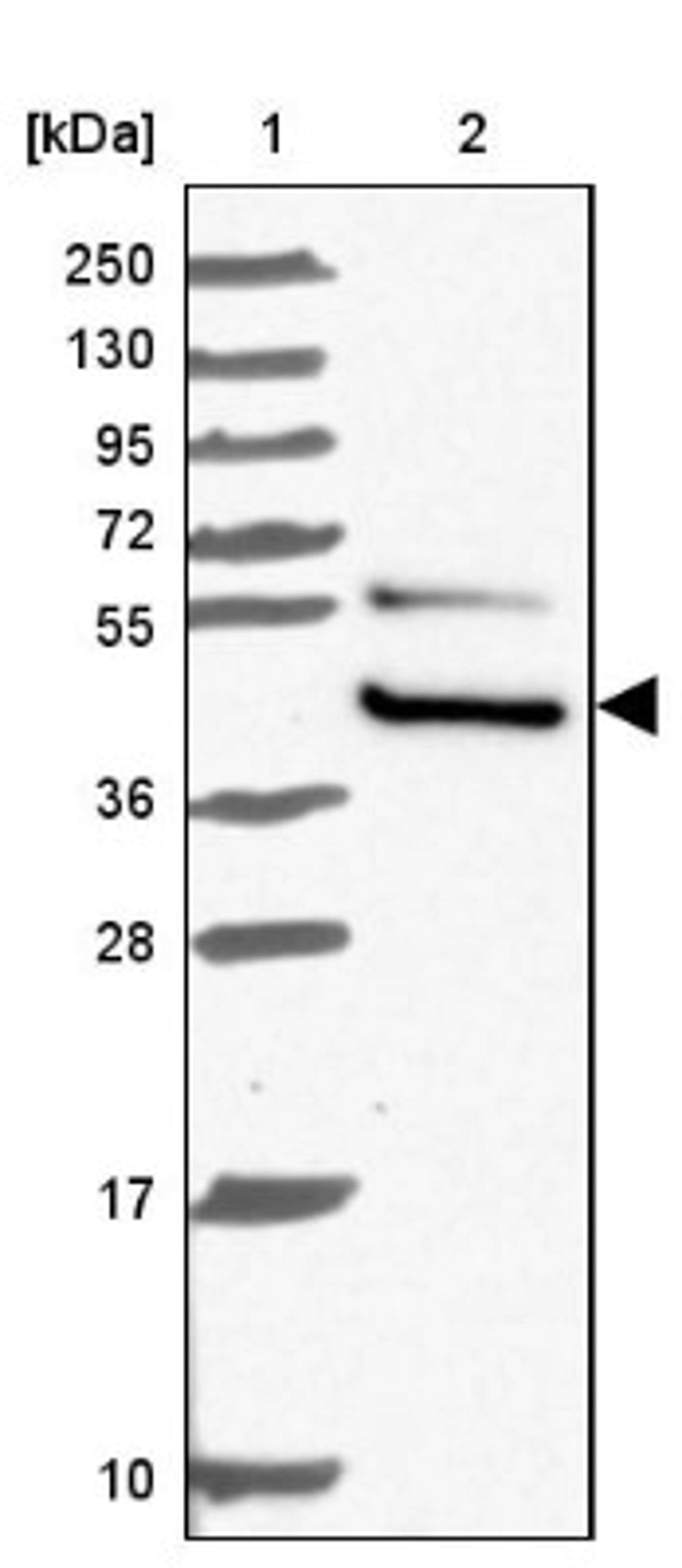 Western Blot: PTOV1 Antibody [NBP2-13826] - Lane 1: Marker [kDa] 250, 130, 95, 72, 55, 36, 28, 17, 10<br/>Lane 2: Human cell line RT-4