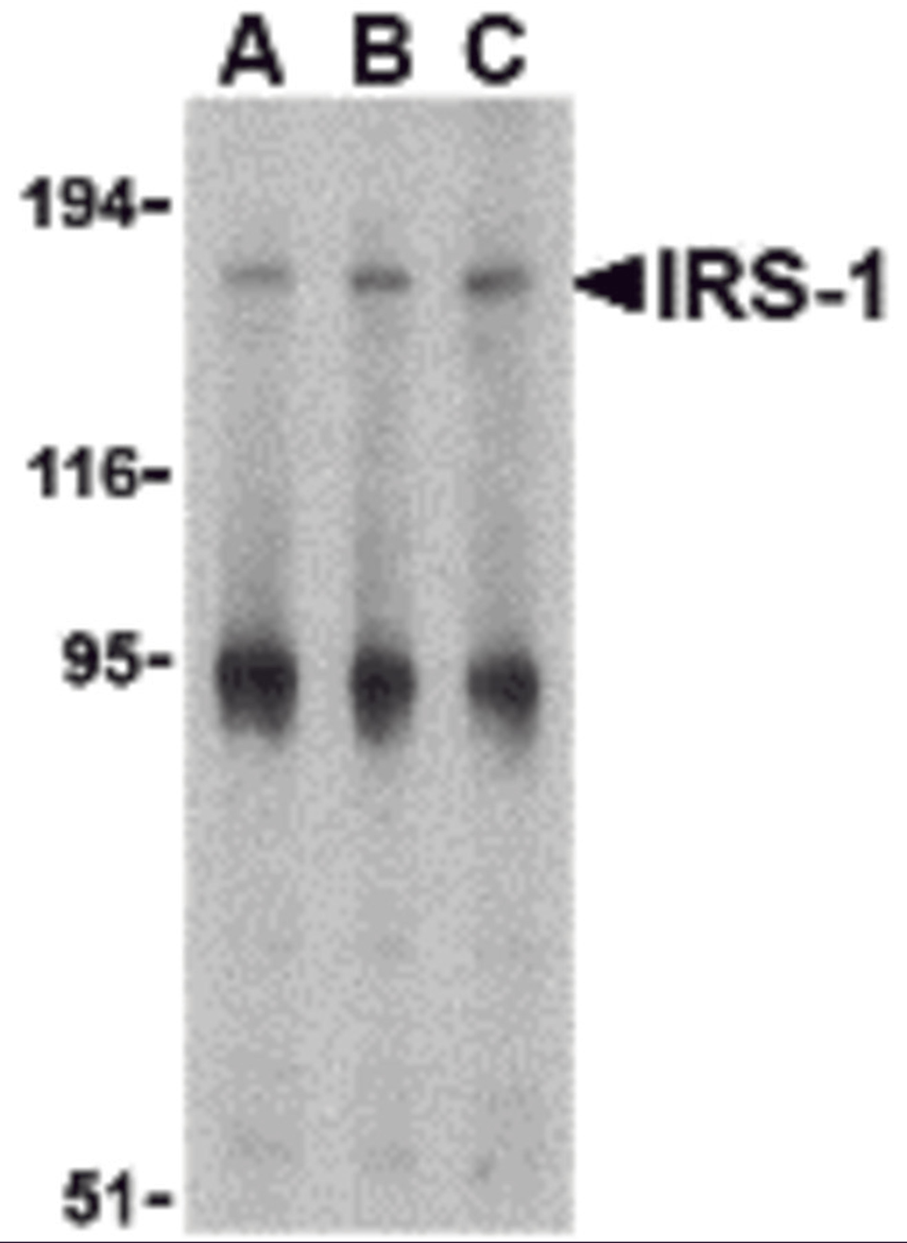 Western blot analysis of IRS-1 in PC-3 cell lysate with IRS-1 antibody at (A) 1, (B) 2 and (C) 4 &#956;g/mL.