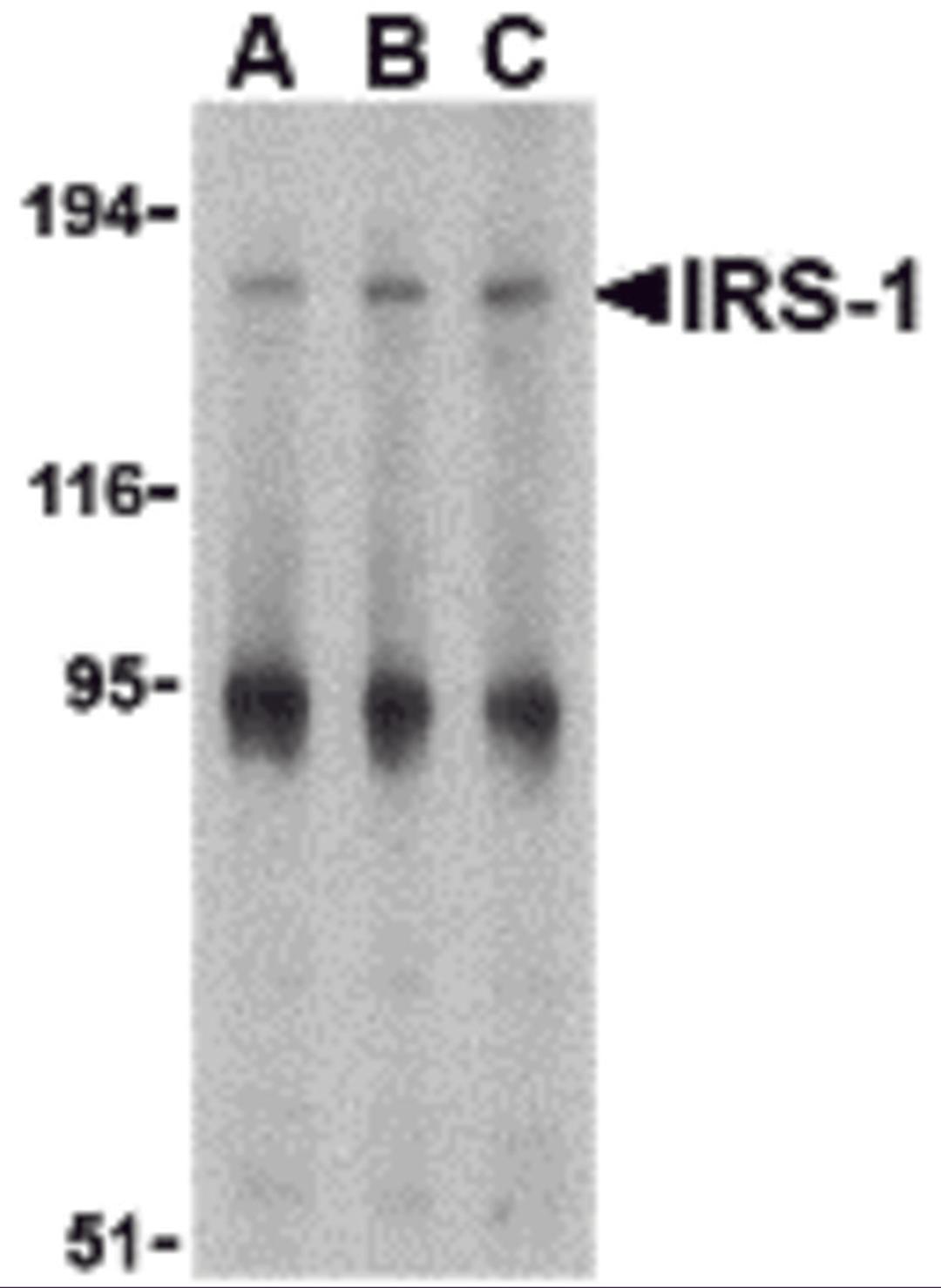 Western blot analysis of IRS-1 in PC-3 cell lysate with IRS-1 antibody at (A) 1, (B) 2 and (C) 4 μg/mL.