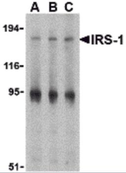 Western blot analysis of IRS-1 in PC-3 cell lysate with IRS-1 antibody at (A) 1, (B) 2 and (C) 4 μg/mL.