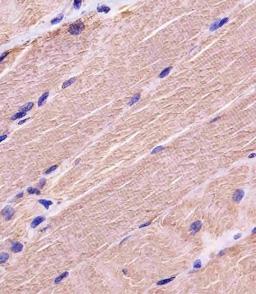 Antibody staining MYBPC3 in human skeletal muscle tissue sections by Immunohistochemistry (IHC-P - paraformaldehyde-fixed, paraffin-embedded sections).