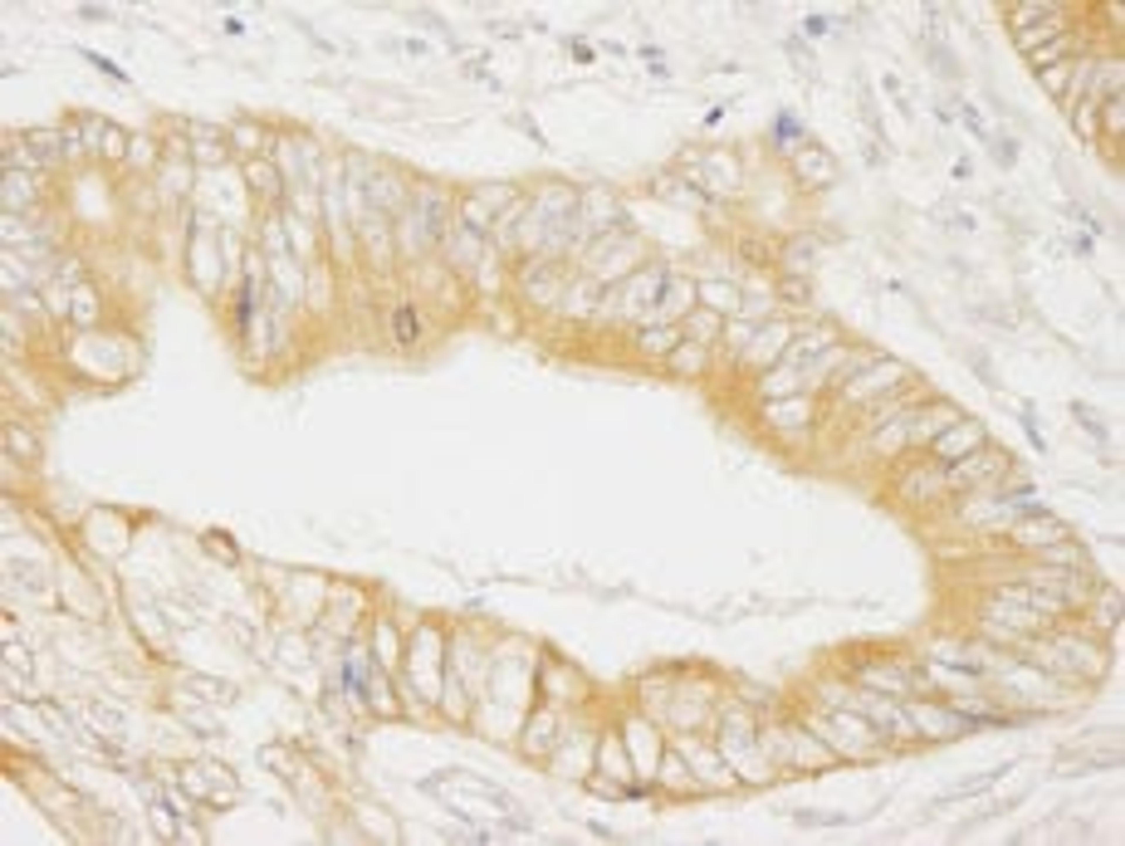 Detection of human MAP4K4/HGK by immunohistochemistry.