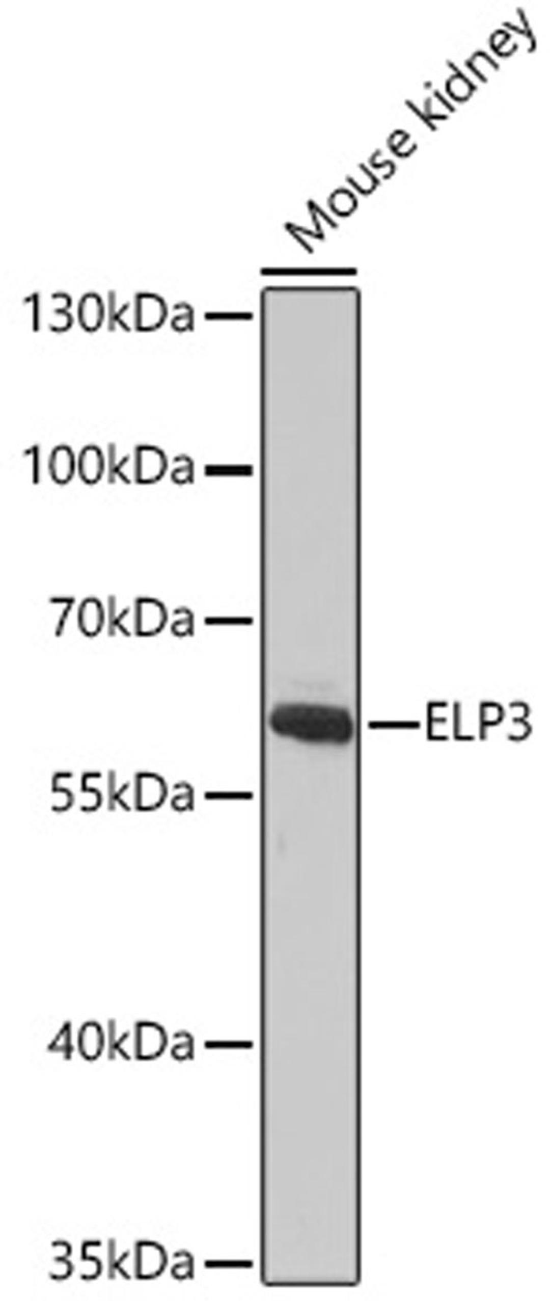 Western blot - ELP3 antibody (A9877)