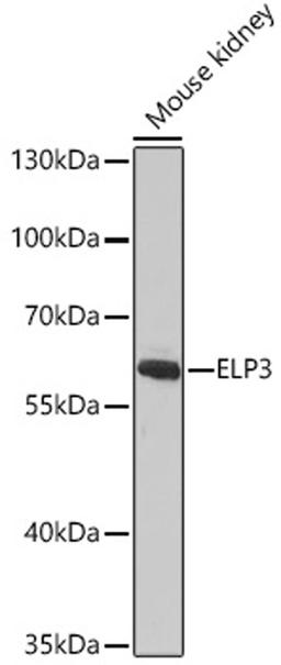 Western blot - ELP3 antibody (A9877)