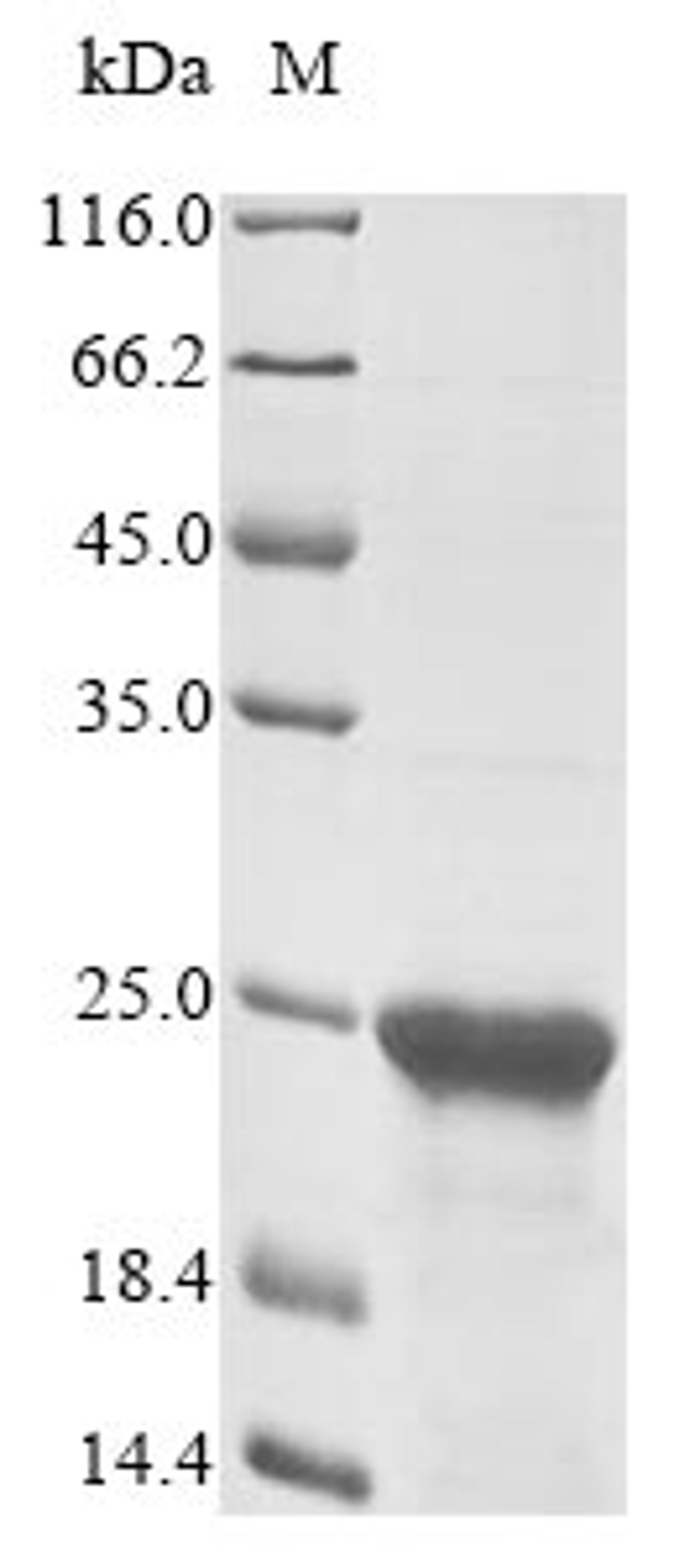 (Tris-Glycine gel) Discontinuous SDS-PAGE (reduced) with 5% enrichment gel and 15% separation gel.