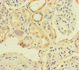 Immunohistochemistry of paraffin-embedded human kidney tissue using CSB-PA890752LA01HU at dilution of 1:100