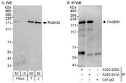 Detection of human PASKIN by western blot and immunoprecipitation.