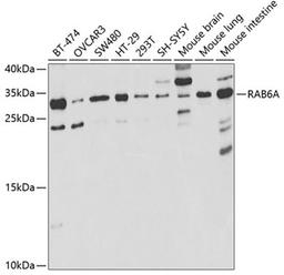 Western blot - RAB6A antibody (A5613)