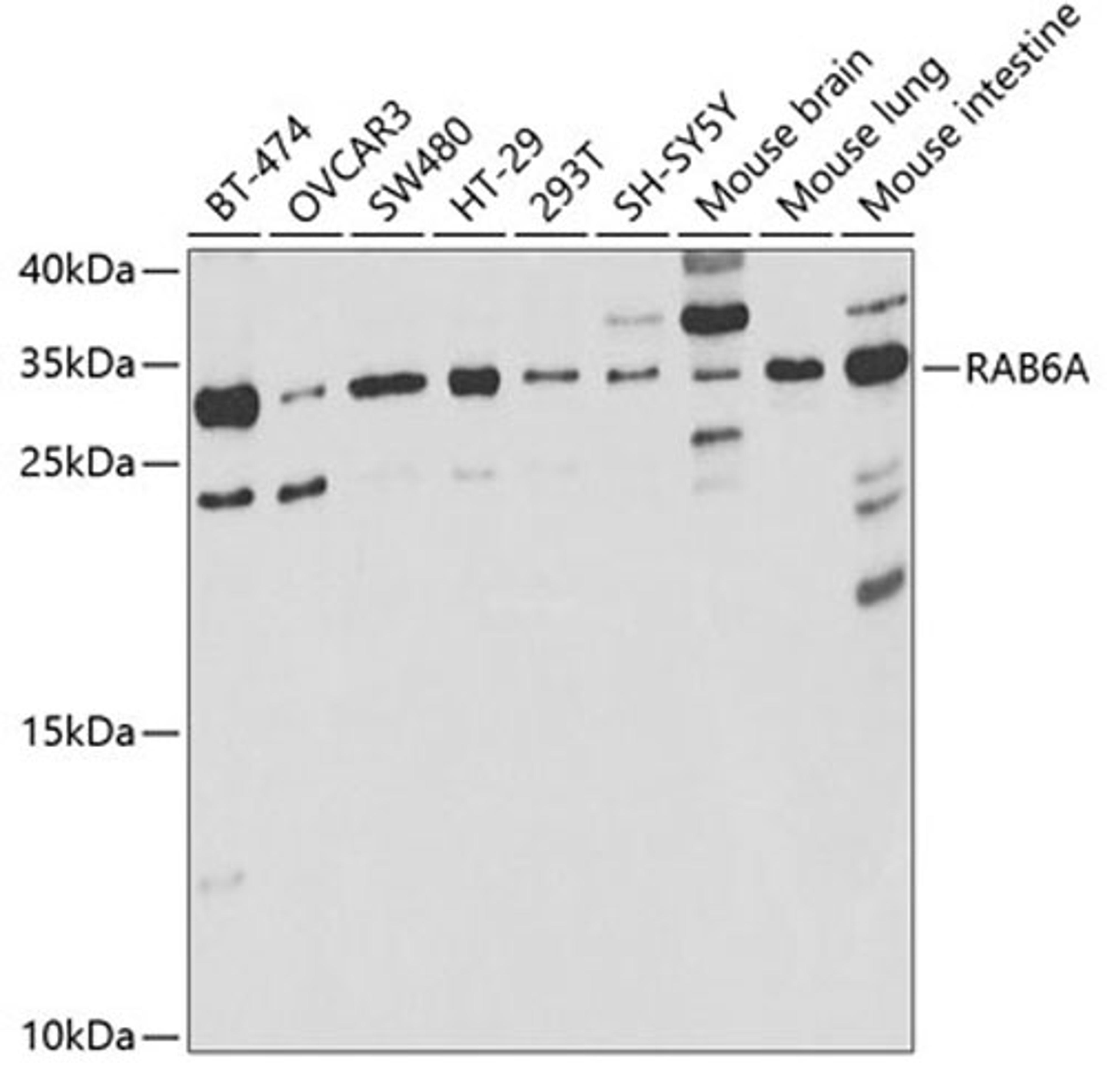 Western blot - RAB6A antibody (A5613)