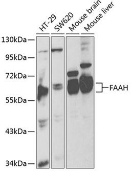 Western blot - FAAH antibody (A1174)