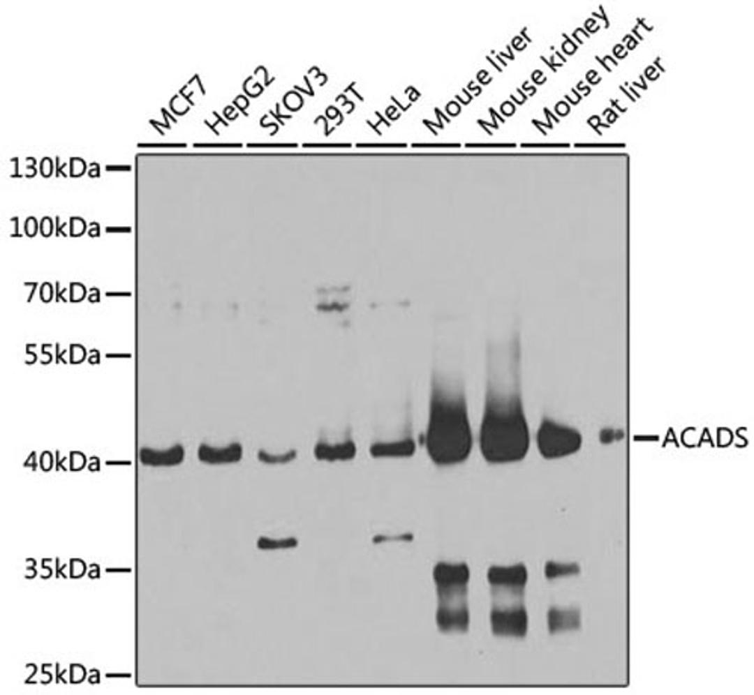 Western blot - ACADS antibody (A7230)