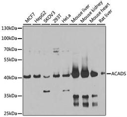 Western blot - ACADS antibody (A7230)