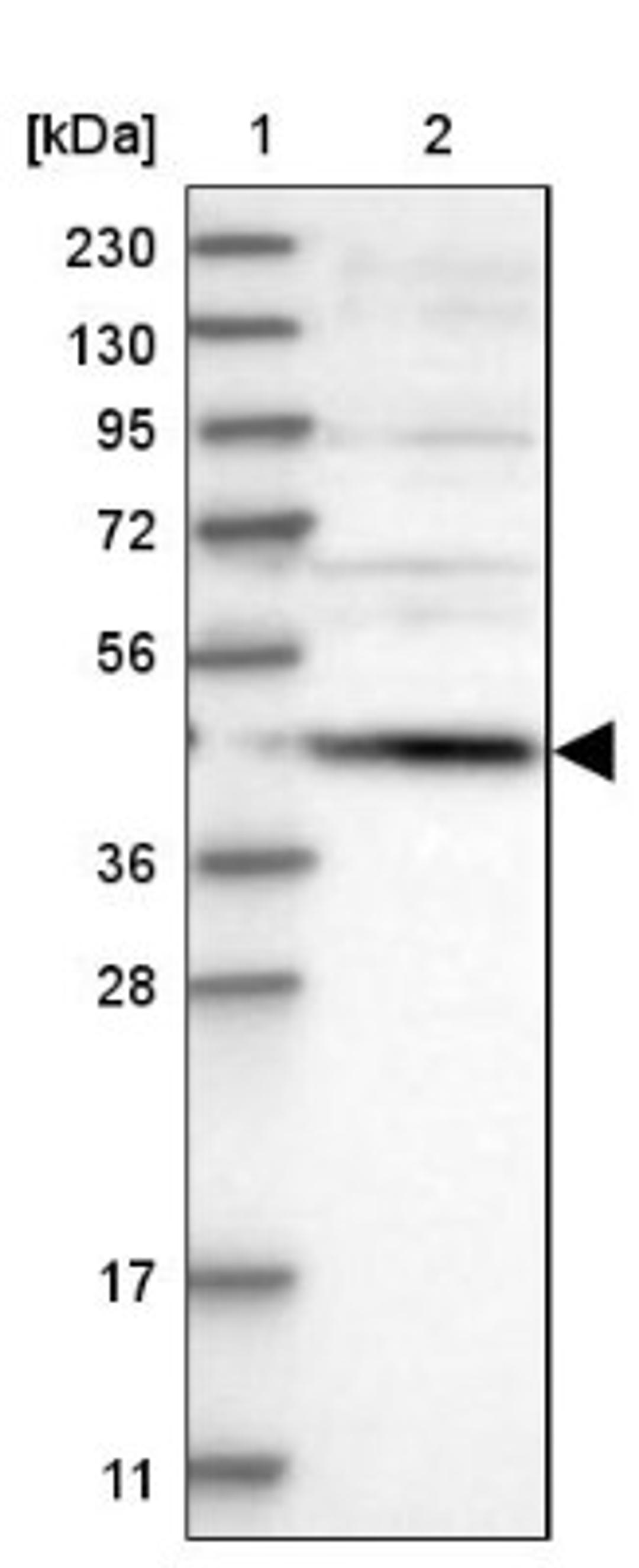 Western Blot: SCRN2 Antibody [NBP1-85994] - Lane 1: Marker [kDa] 230, 130, 95, 72, 56, 36, 28, 17, 11<br/>Lane 2: Human cell line RT-4