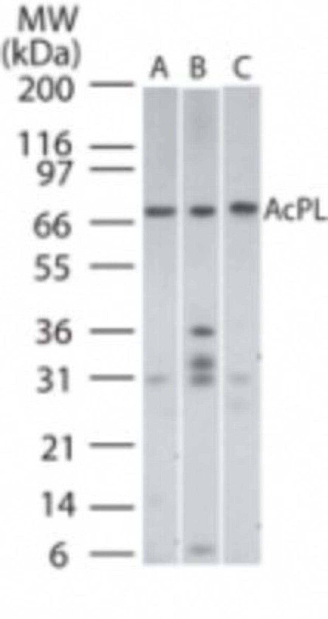 Western Blot: ACPL Antibody [NB100-56433] - Analysis of IL-18 RA/AcPL in (A) Human Spleen, (B) Mouse spleen, and (C) Mouse RAW cell lysate using this antibody.