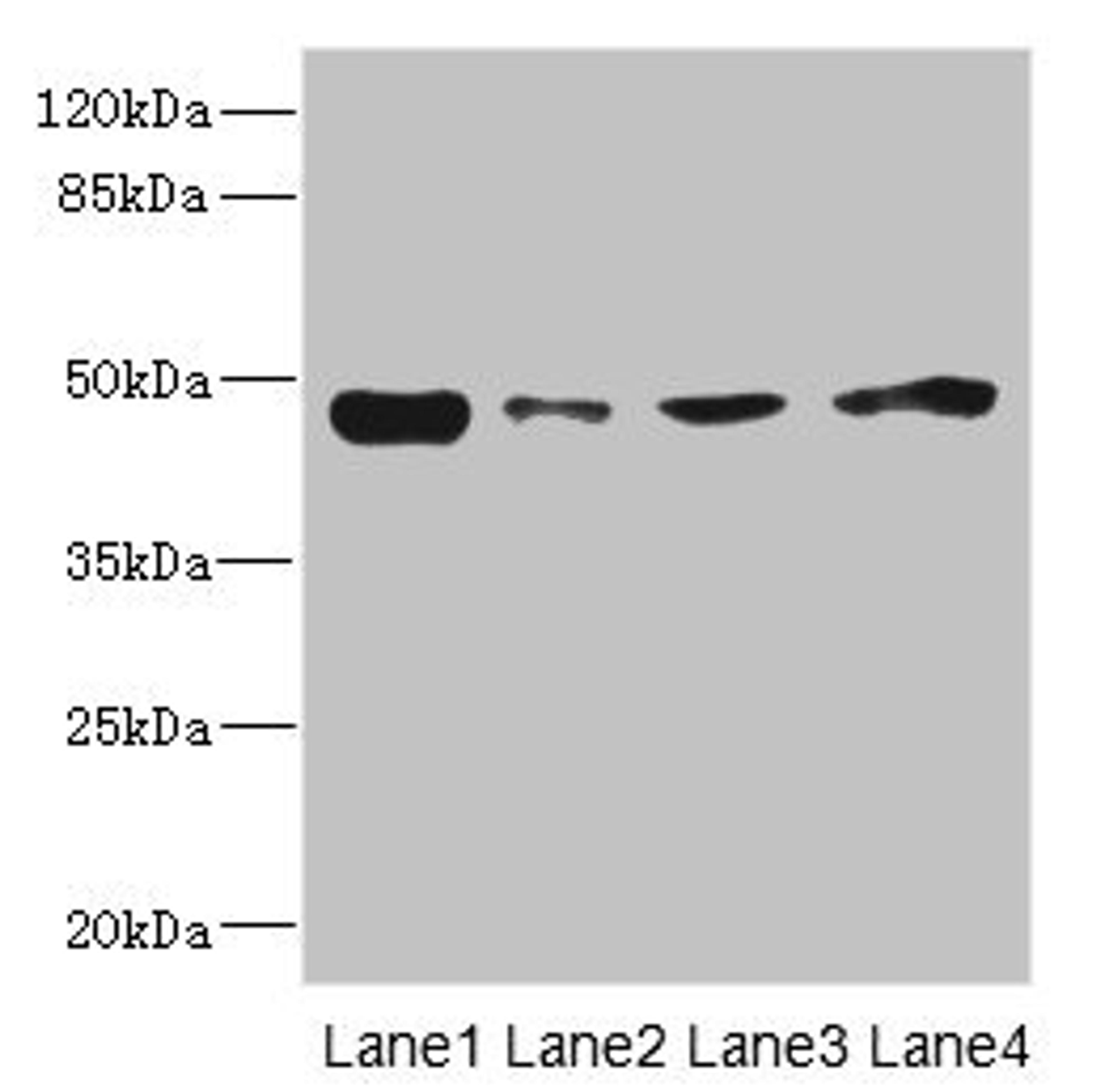 Western blot. All lanes: PDK3 antibody at 1.6µg/ml. Lane 1: Mouse kidney tissue. Lane 2: RAW264.7 whole cell lysate. Lane 3: A431 whole cell lysate. Lane 4: HepG2 whole cell lysate. Secondary. Goat polyclonal to rabbit IgG at 1/10000 dilution. Predicted band size: 47, 49 kDa. Observed band size: 47 kDa