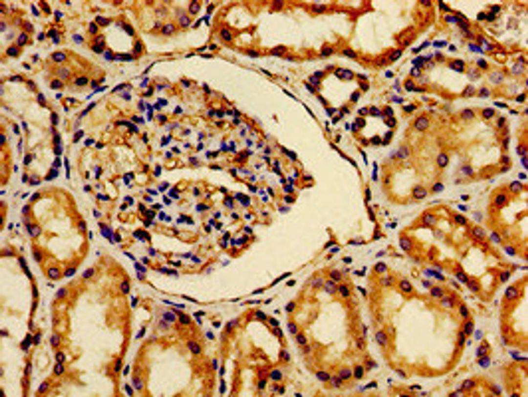 Immunohistochemistry of paraffin-embedded human kidney tissue using CSB-PA002470LA01HU at dilution of 1:100
