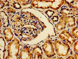 Immunohistochemistry of paraffin-embedded human kidney tissue using CSB-PA002470LA01HU at dilution of 1:100