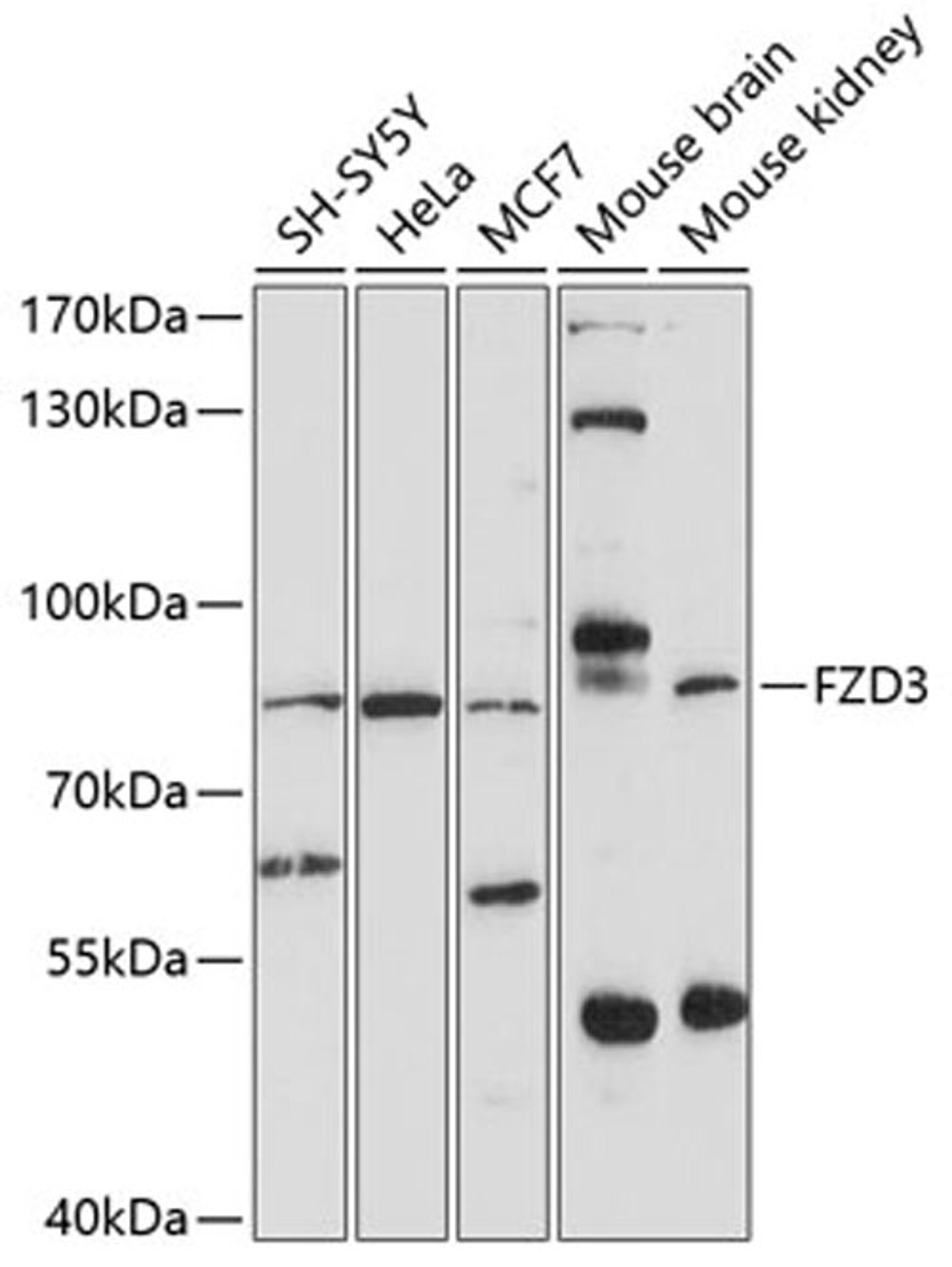 Western blot - FZD3 antibody (A10063)