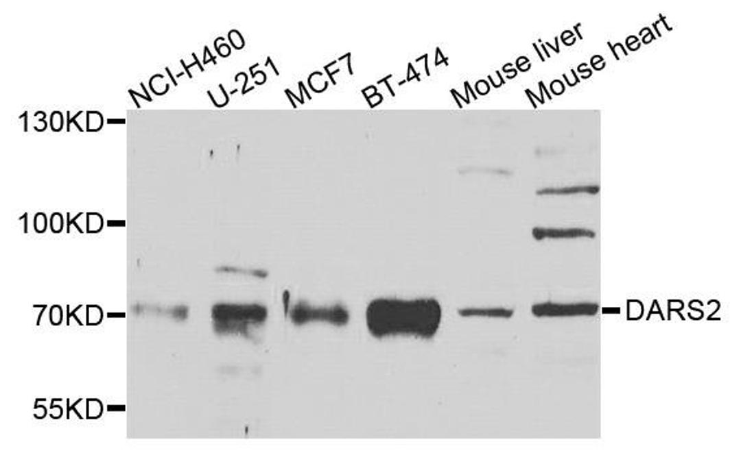 Western blot analysis of extracts of various cells using DARS2 antibody