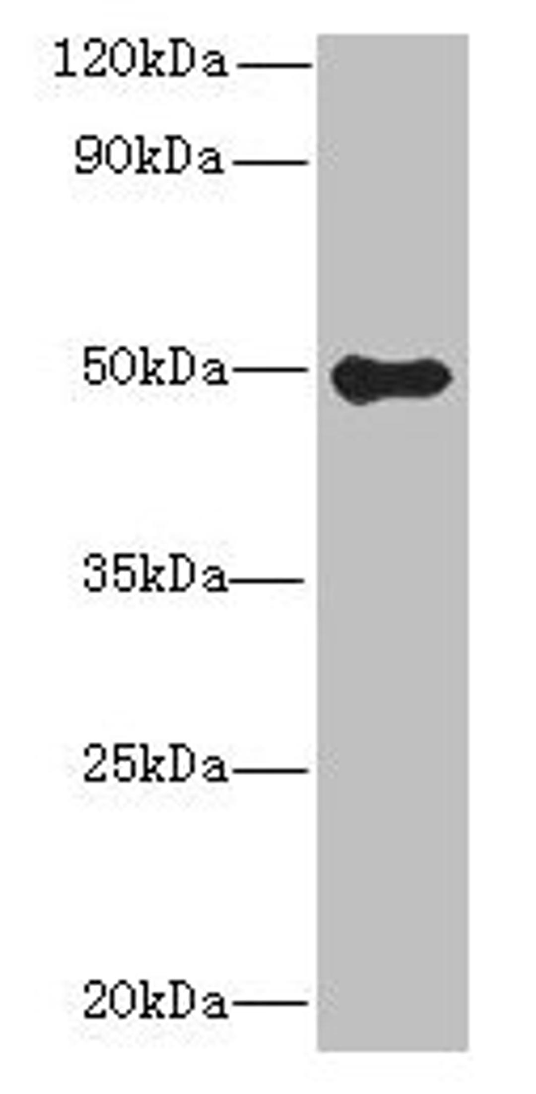 Western blot. All lanes: GSDMB antibody at 8µg/ml + Colo320 whole cell lysate. Secondary. Goat polyclonal to rabbit IgG at 1/10000 dilution. Predicted band size: 47, 46, 48, 19 kDa. Observed band size: 47 kDa