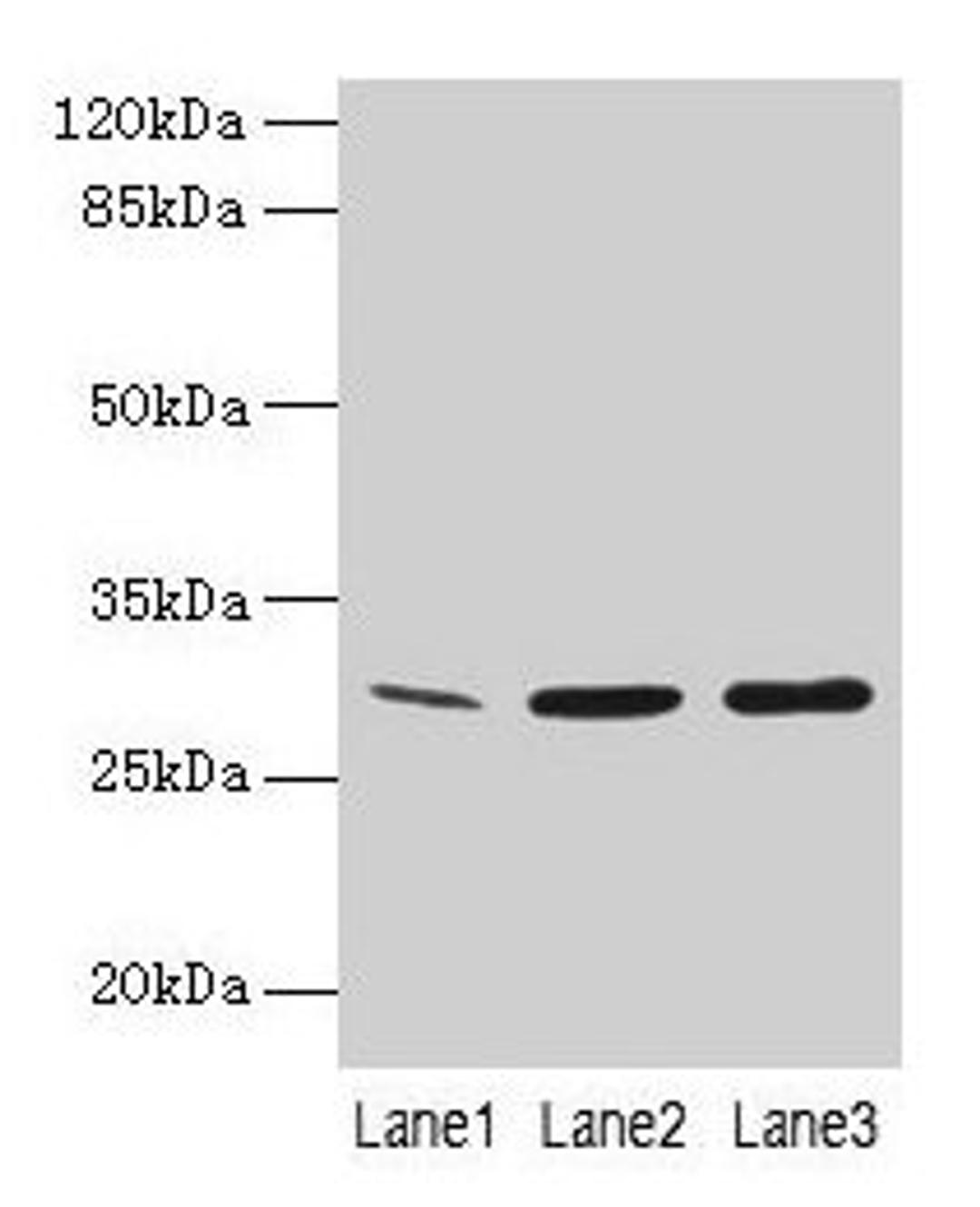 Western Blot. All lanes: GTF2F2 antibody at 16µg/ml. Lane 1: Mouse spleen tissue. Lane 2: K562 whole cell lysate. Lane 3: A549 whole cell lysate. Secondary. Goat polyclonal to rabbit IgG at 1/10000 dilution. Predicted band size: 29 kDa. Observed band size: 29 kDa