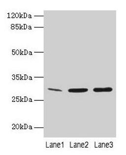 Western Blot. All lanes: GTF2F2 antibody at 16µg/ml. Lane 1: Mouse spleen tissue. Lane 2: K562 whole cell lysate. Lane 3: A549 whole cell lysate. Secondary. Goat polyclonal to rabbit IgG at 1/10000 dilution. Predicted band size: 29 kDa. Observed band size: 29 kDa