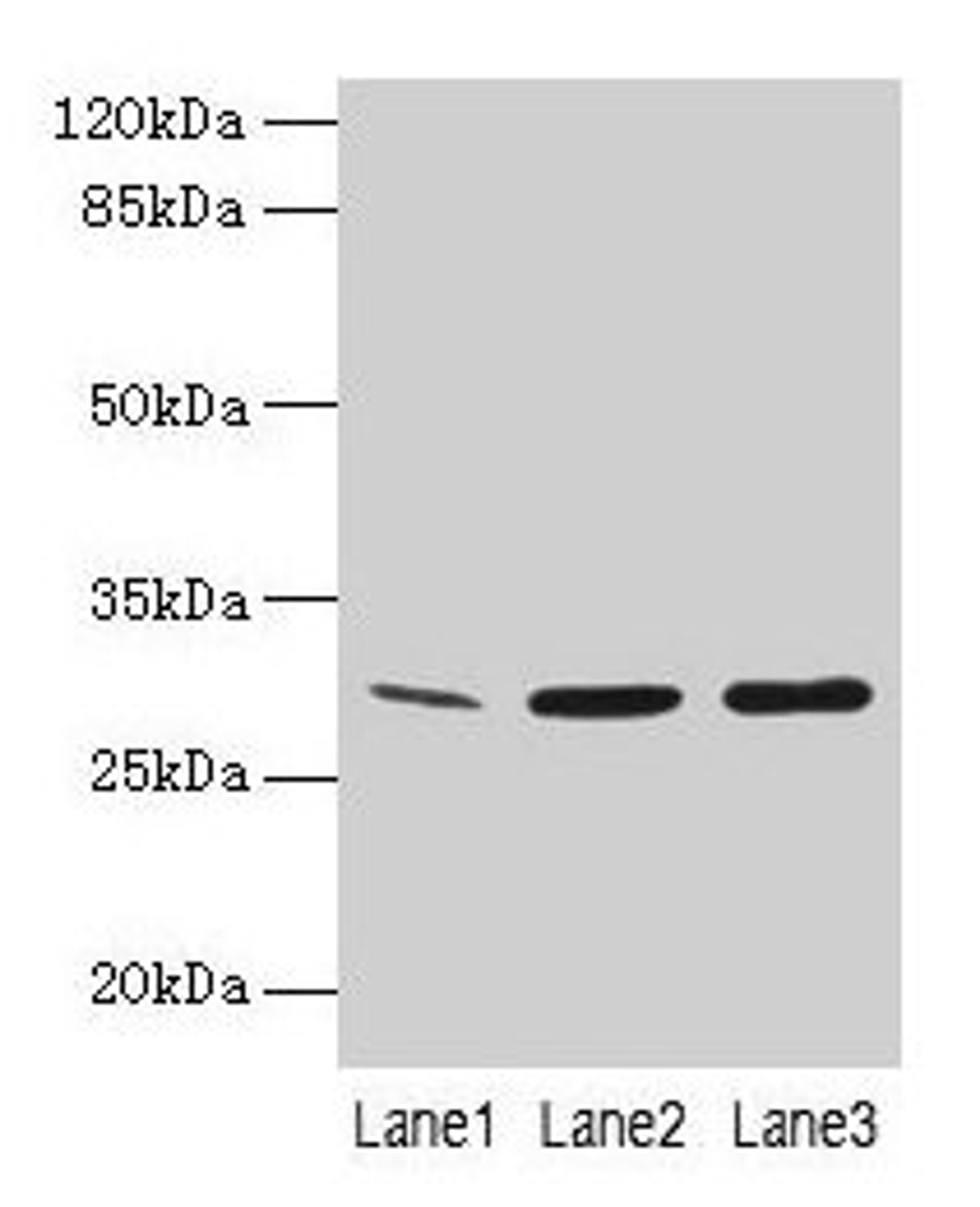 Western Blot. All lanes: GTF2F2 antibody at 16µg/ml. Lane 1: Mouse spleen tissue. Lane 2: K562 whole cell lysate. Lane 3: A549 whole cell lysate. Secondary. Goat polyclonal to rabbit IgG at 1/10000 dilution. Predicted band size: 29 kDa. Observed band size: 29 kDa