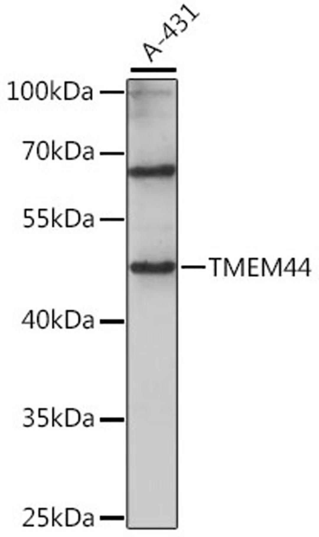 Western blot - TMEM44 antibody (A15932)