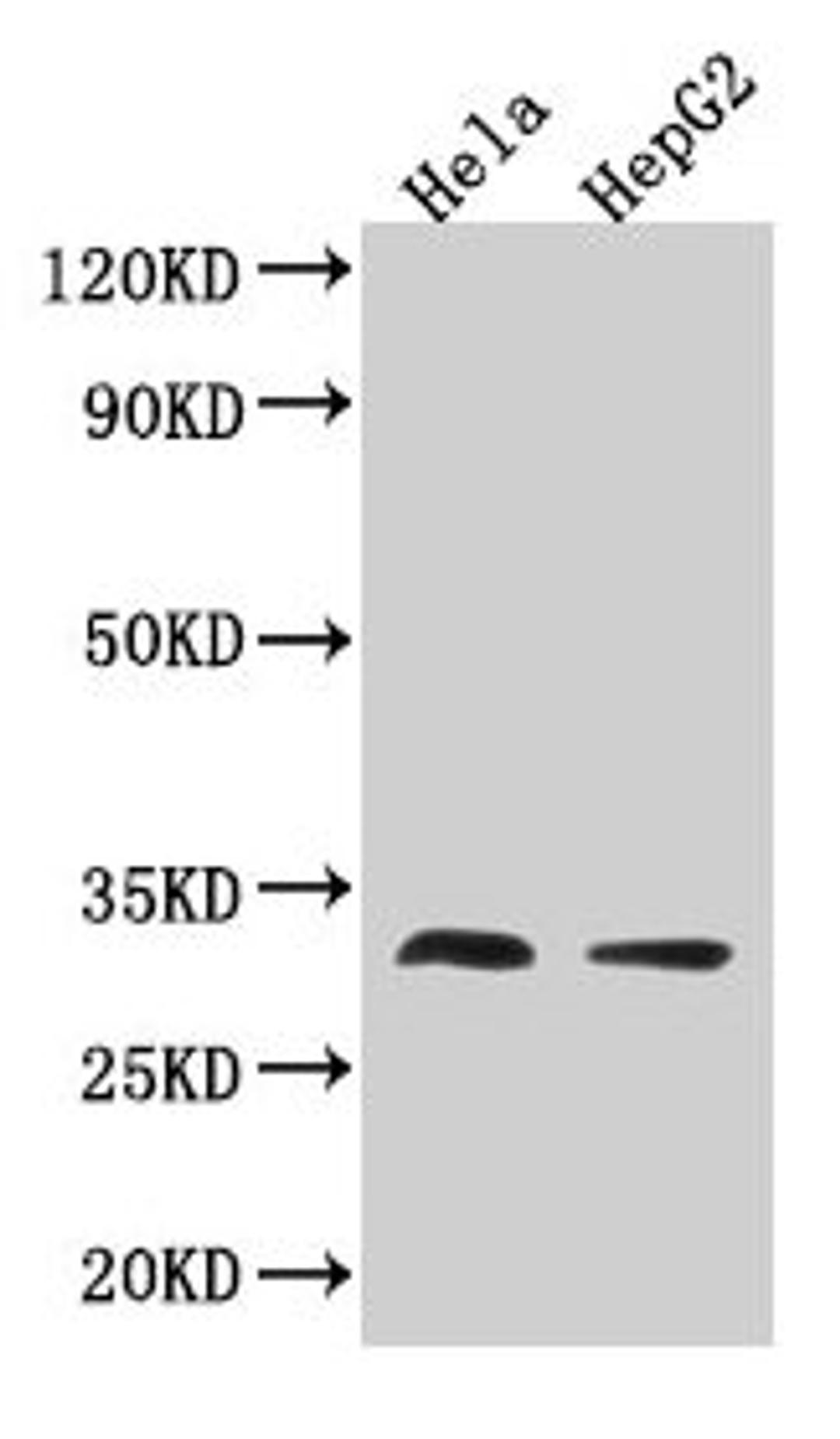 Western Blot. Positive WB detected in: Hela whole cell lysate, HepG2 whole cell lysate. All lanes: TMEM192 antibody at 3.2µg/ml. Secondary. Goat polyclonal to rabbit IgG at 1/50000 dilution. Predicted band size: 31 kDa. Observed band size: 31 kDa