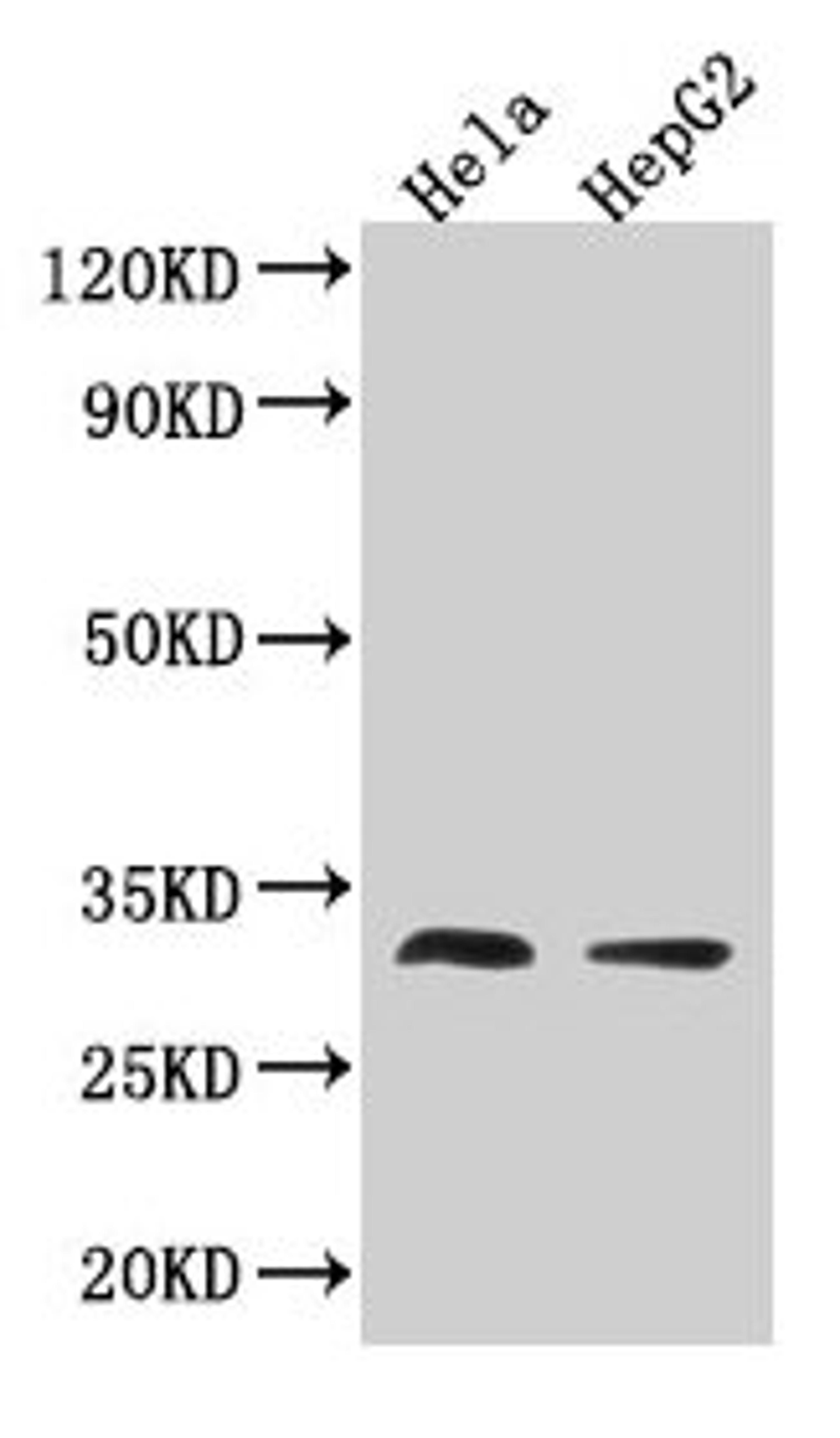 Western Blot. Positive WB detected in: Hela whole cell lysate, HepG2 whole cell lysate. All lanes: TMEM192 antibody at 3.2µg/ml. Secondary. Goat polyclonal to rabbit IgG at 1/50000 dilution. Predicted band size: 31 kDa. Observed band size: 31 kDa