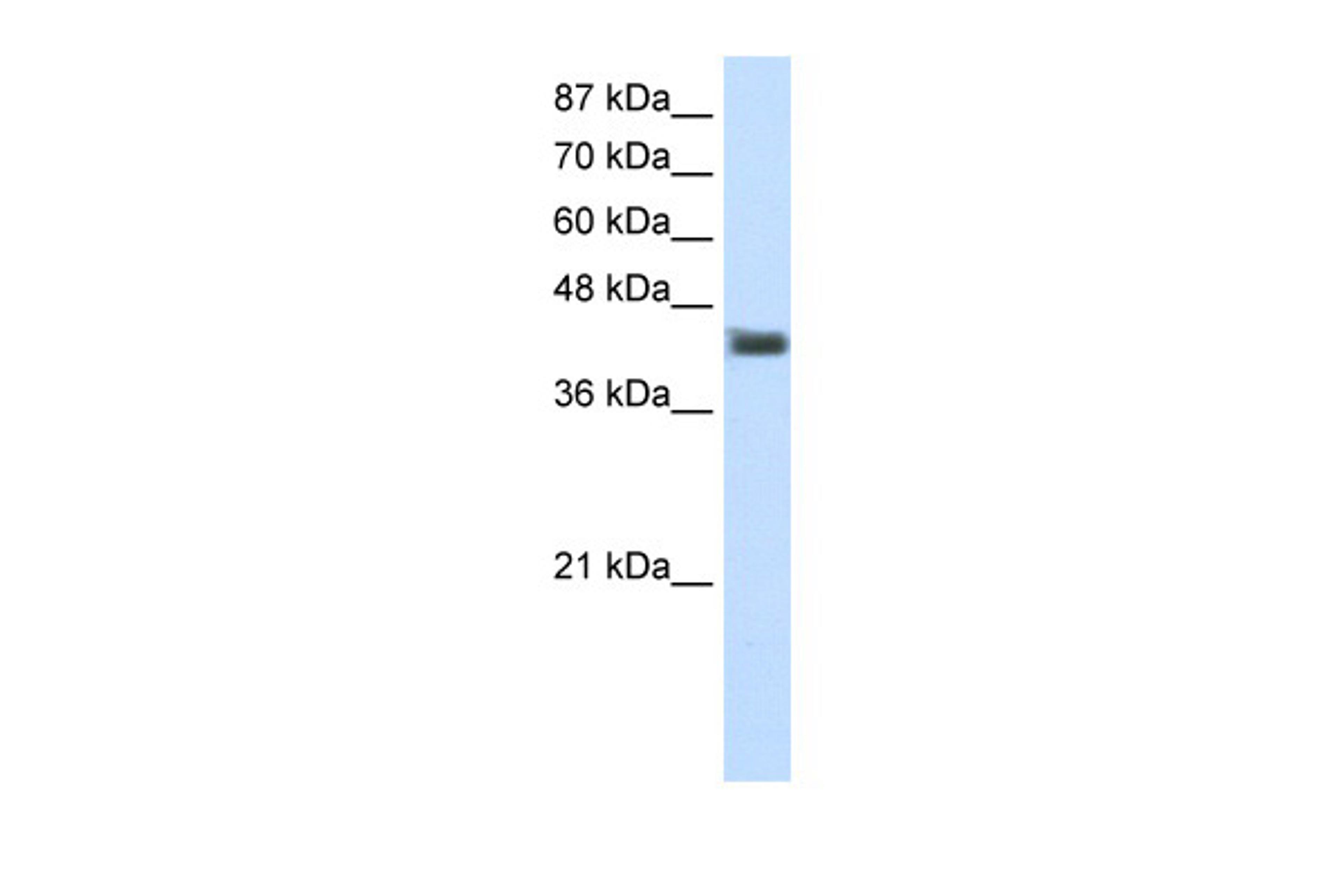 Antibody used in WB on Human HepG2 at 1.25 ug/ml.