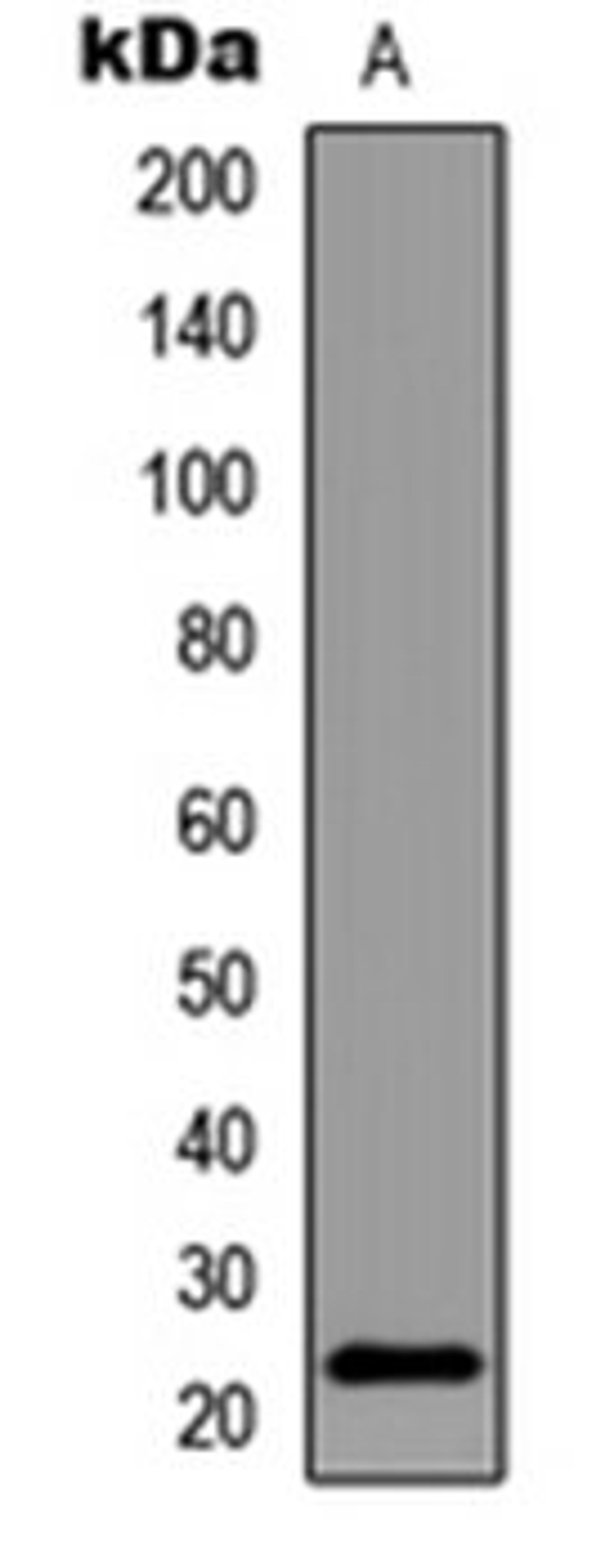 Western blot analysis of HeLa Forskolin-treated (Lane 1) whole cell lysates using BAD (phospho-S155) antibody