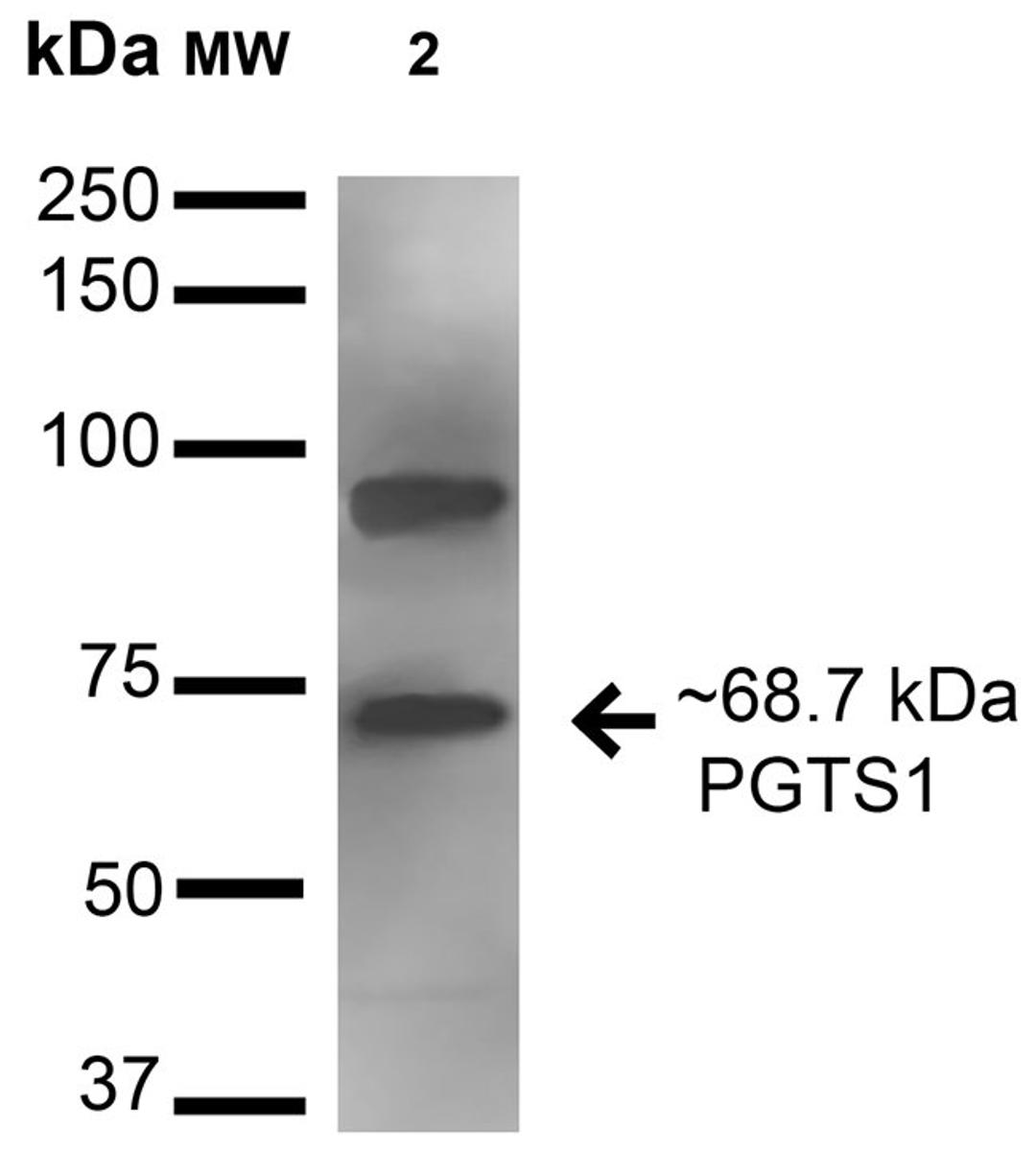 Western Blot analysis of human hela and 293trap cell lysates using Cyclooxygenase 1 antibody