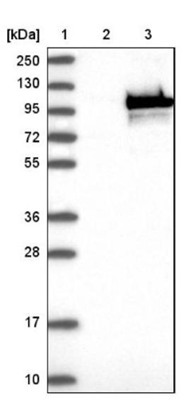 Western Blot: CoCoA Antibody [NBP1-88215] - Lane 1: Marker [kDa] 250, 130, 95, 72, 55, 36, 28, 17, 10<br/>Lane 2: Negative control (vector only transfected HEK293T lysate)<br/>Lane 3: Over-expression lysate (Co-expressed with a C-terminal myc-DDK tag (~3.1 kDa) in mammalian HEK293T cells, LY412204)