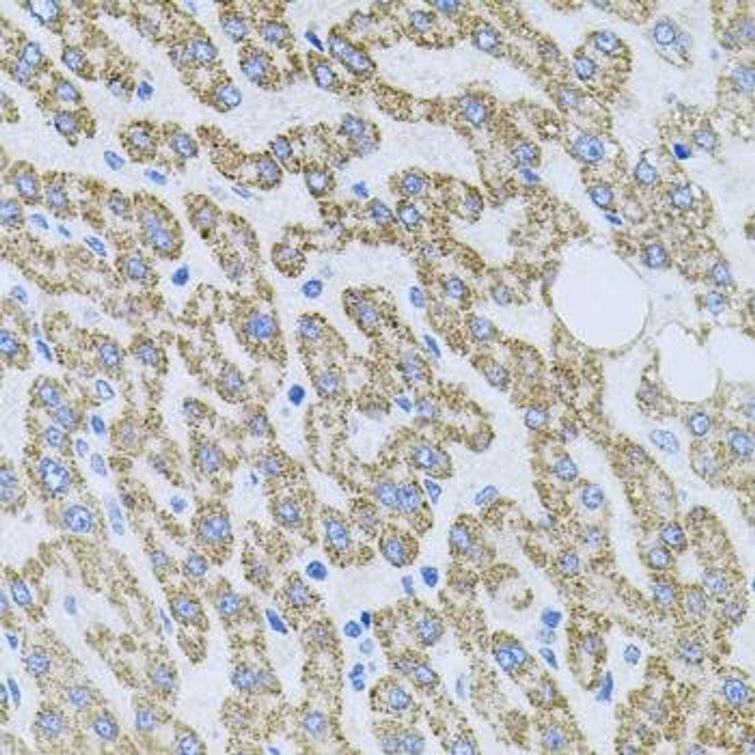 Immunohistochemical staining of human colon tissue using NTF4 antibody (dilution of 1:100)