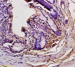 Paraffin-embedded mouse liver tissue fixed with 4% paraformaldehyde.Antigen retrieval by boiling with citrate buffer.Blocking buffer is goat serum (37'C for 20min) Phospho-GCN2 (Thr899) antibody at 1:200 with overnight incubation at 4 degrees