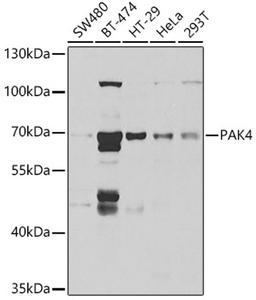 Western blot - PAK4 antibody (A2782)