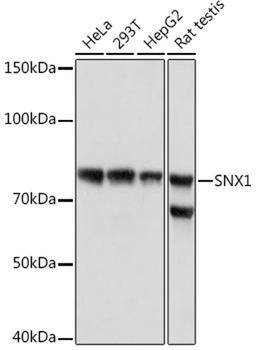Western blot - SNX1 Rabbit mAb (A3398)