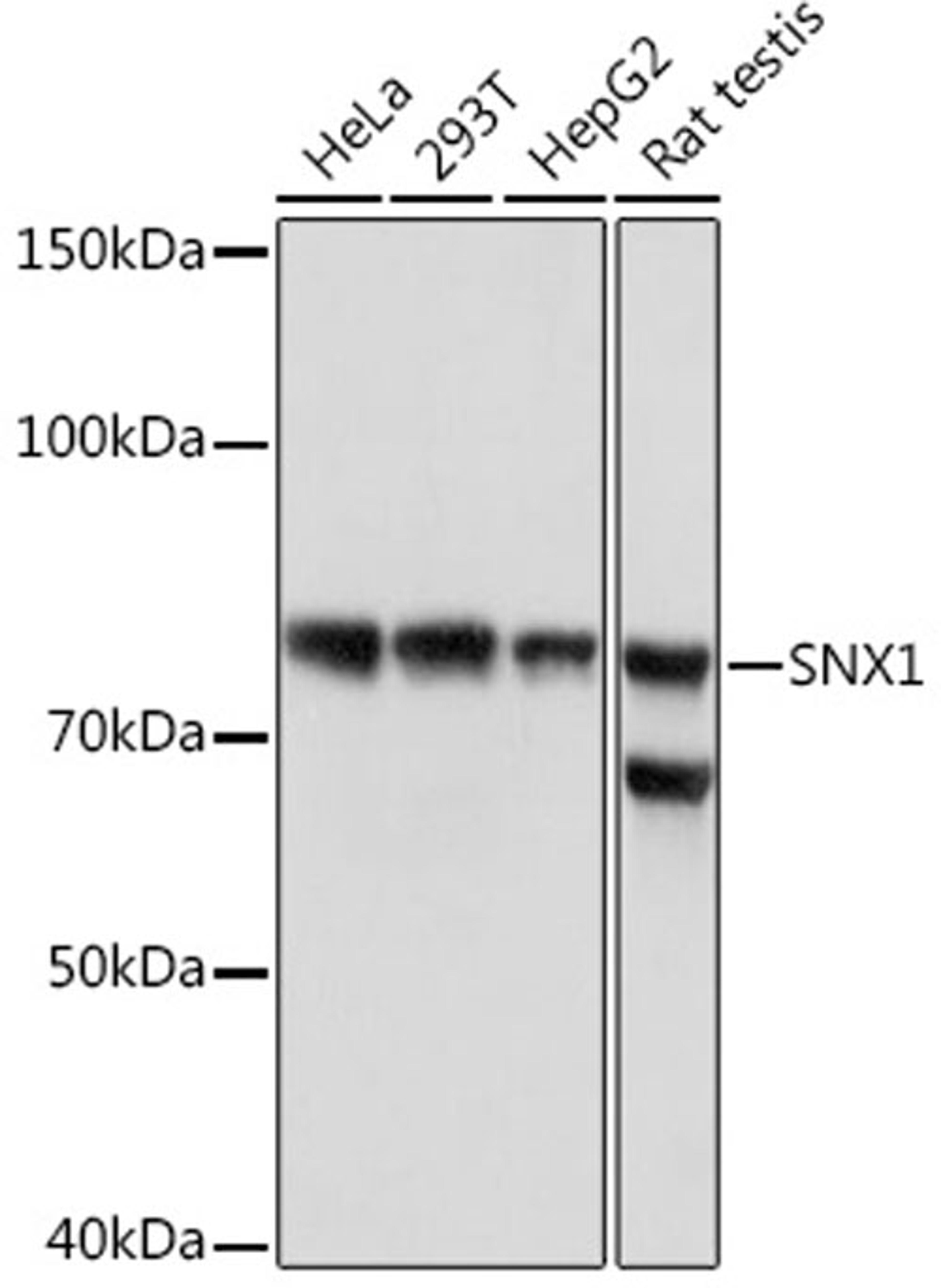 Western blot - SNX1 Rabbit mAb (A3398)