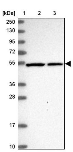 Western Blot: SLC24A6 Antibody [NBP1-83607] - Lane 1: Marker [kDa] 250, 130, 95, 72, 55, 36, 28, 17, 10<br/>Lane 2: Human cell line RT-4<br/>Lane 3: Human cell line U-251MG sp