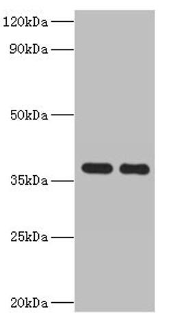 Western blot. All lanes: GALM antibody at 2µg/ml. Lane 1: Mouse kidney tissue. Lane 2: Rat adrenal gland tissue. Secondary. Goat polyclonal to rabbit IgG at 1/10000 dilution. Predicted band size: 38 kDa. Observed band size: 38 kDa
