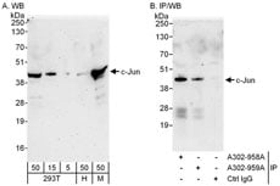 Detection of human and mouse c-Jun by western blot (h&m) and immunoprecipitation (h).